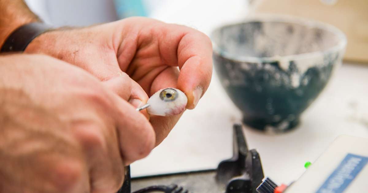Comment remettre une prothèse oculaire Lyon